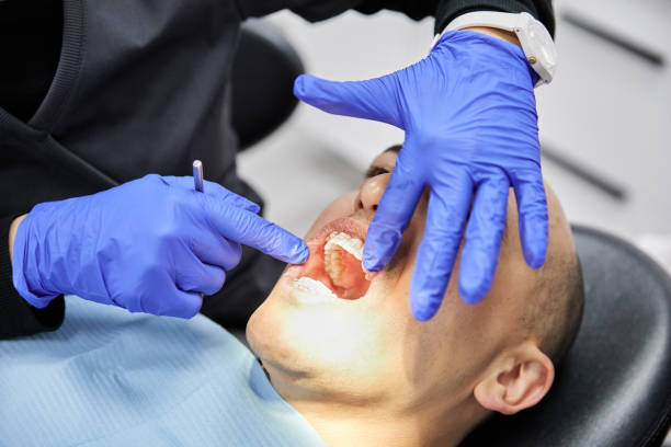 Best Emergency Wisdom Tooth Extraction in Windsor, IL